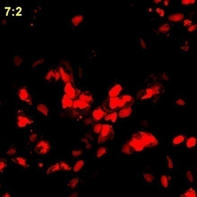 Fluorescent microscopy of U-2 OS cells transfected with a HaloTag®-NLS3 Vector using the FuGENE® HD Transfection Reagent.