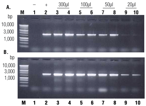 PCR analysis of genomic DNA isolated from decreasing amounts of whole blood.