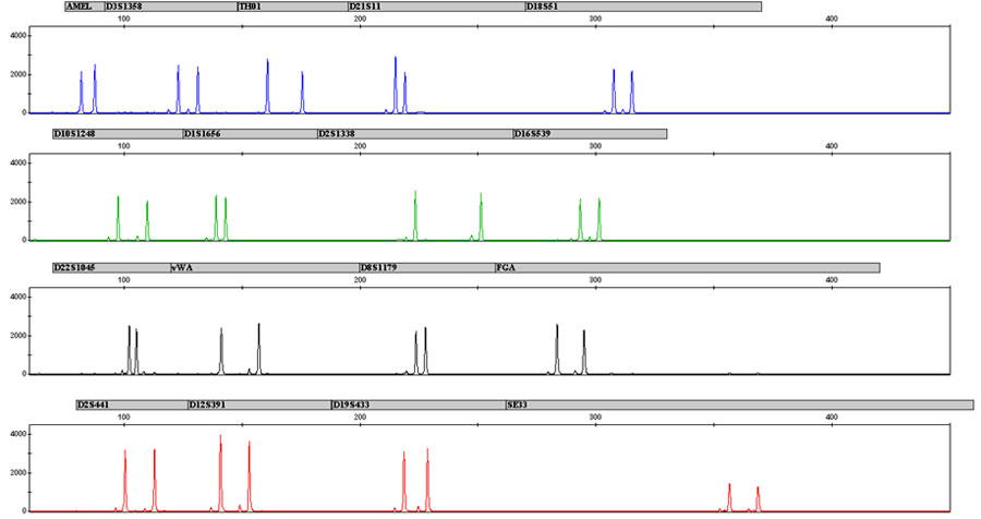 Resistance of the PowerPlex ESX 17 System to hematin.